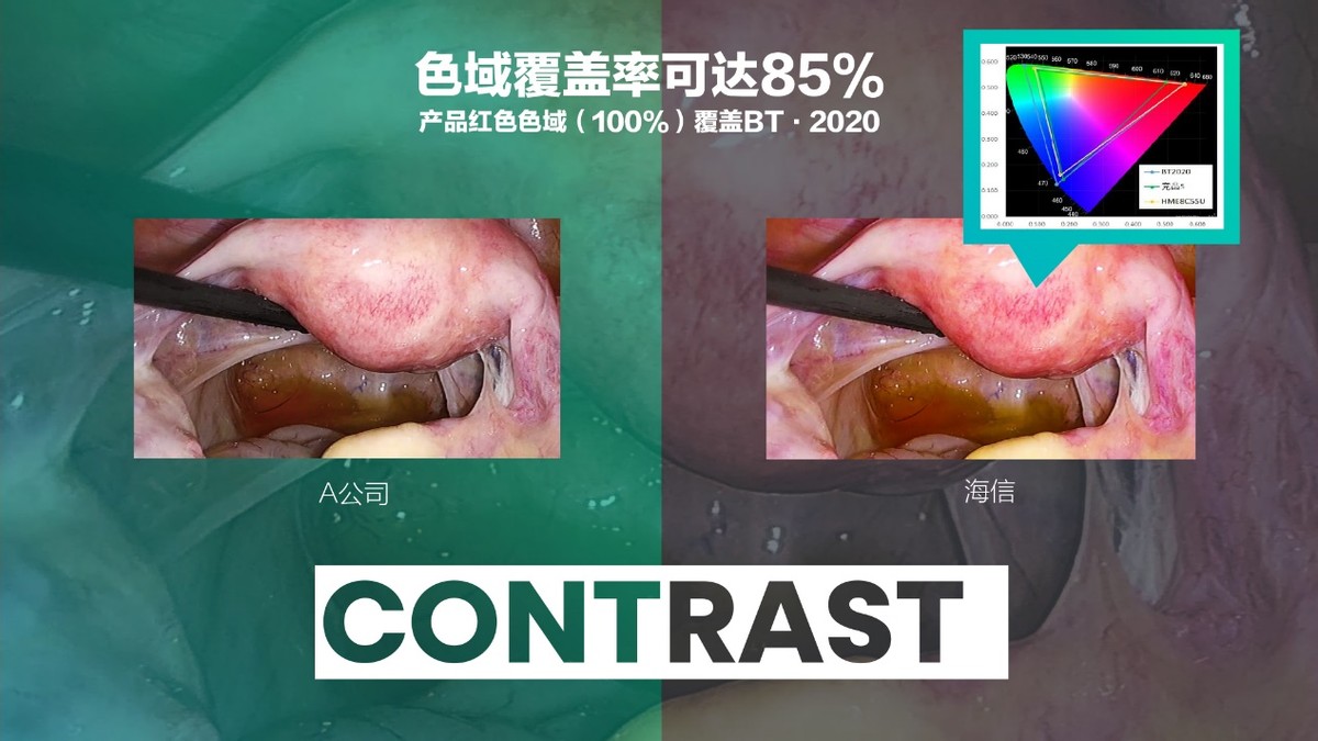 用天花板顶破天花板!海信医疗摘下“皇冠上的明珠”