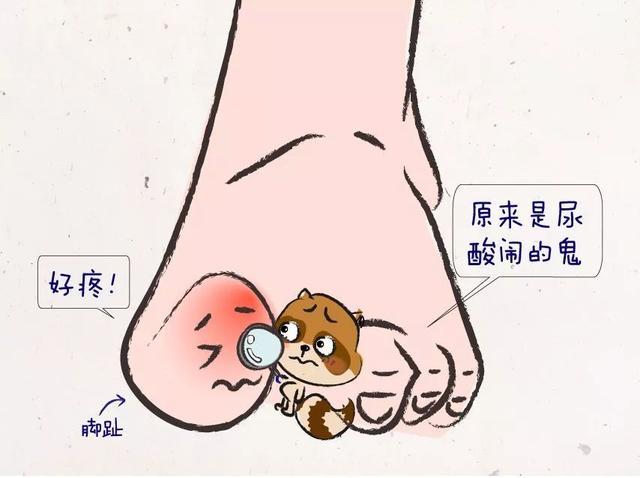 如何判断体内的尿酸升高?出现这三种情况就要注意了