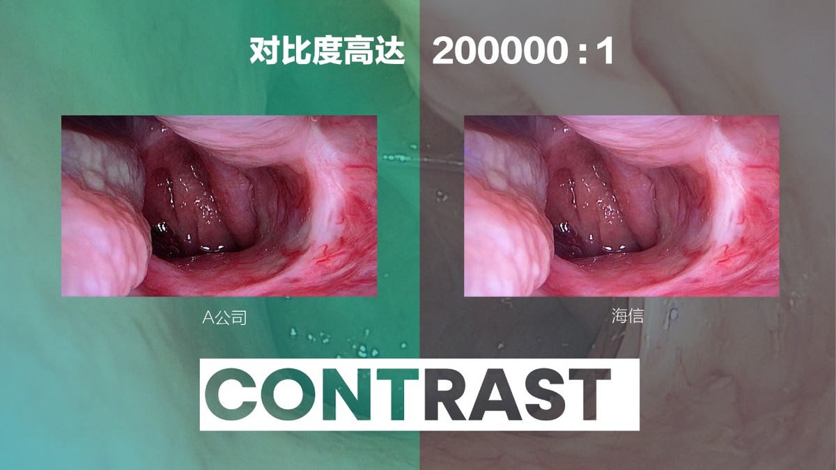 用天花板顶破天花板!海信医疗摘下“皇冠上的明珠”